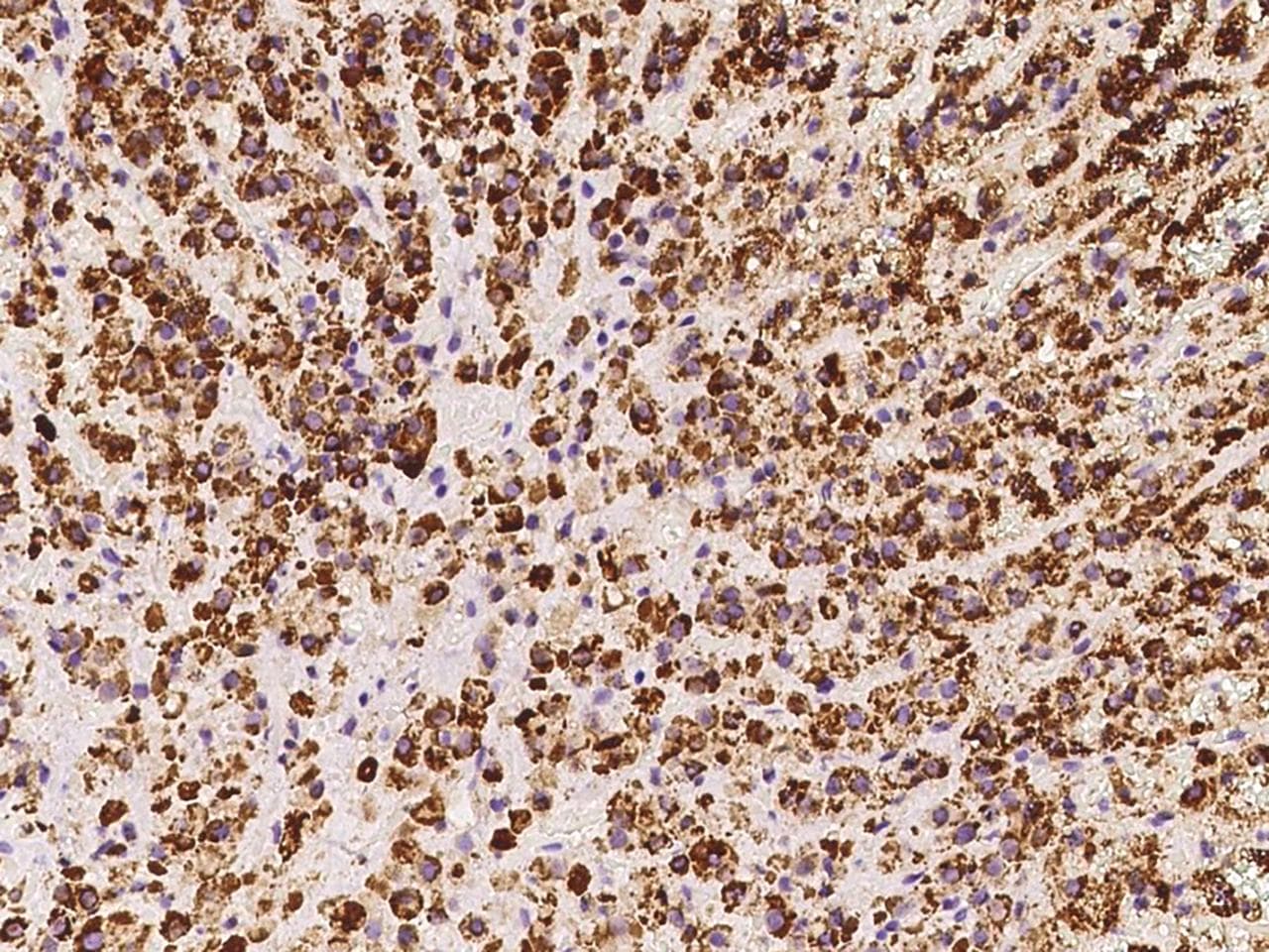 HSDL2 Antibody