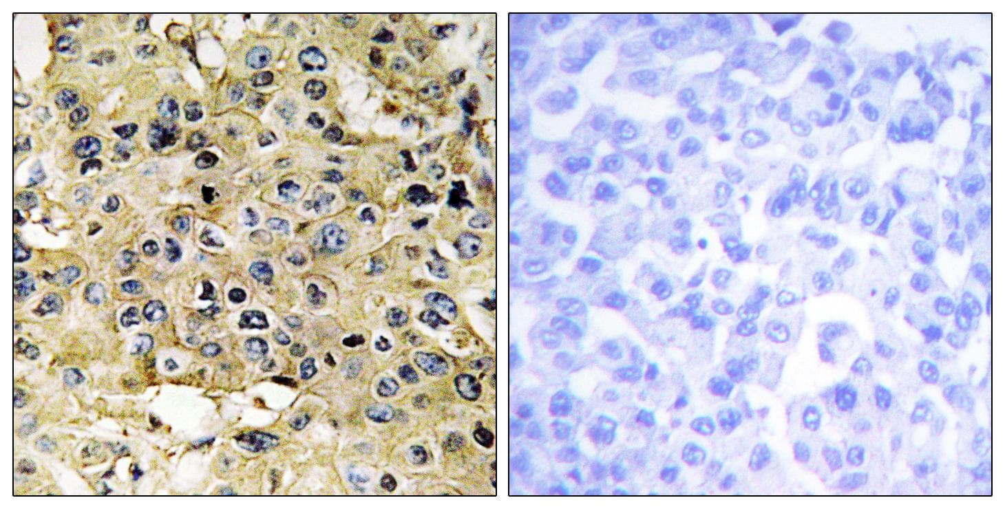 TMPRSS15 / Enterokinase Antibody