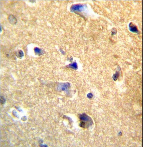 Polyclonal Rabbit anti-Human CDH22 / Cadherin 22 Antibody (aa411-440, IHC, WB)
