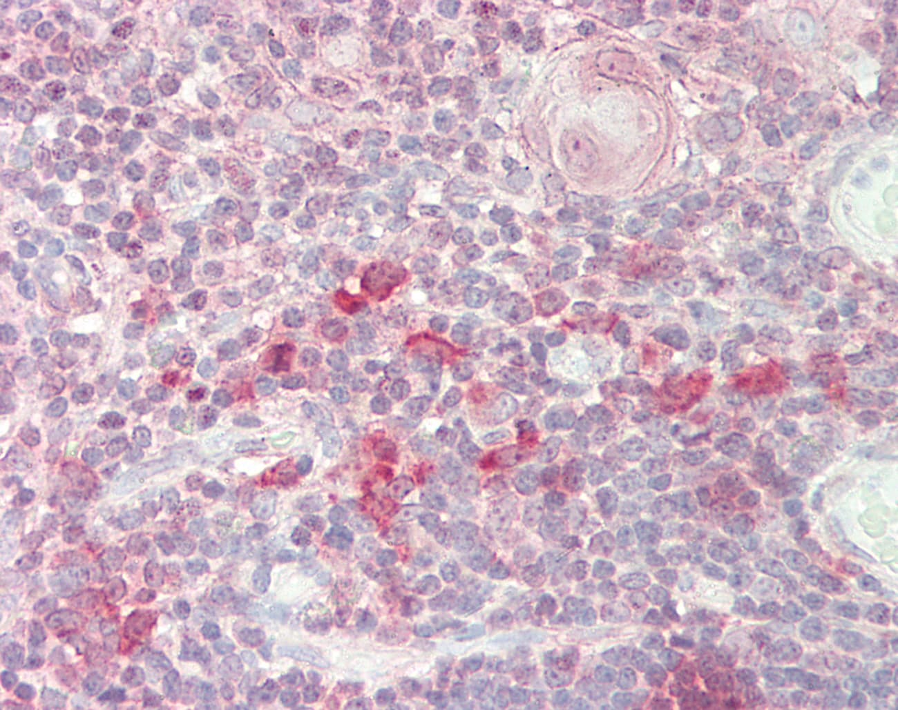 RPA70 / RPA1 Antibody (aa359-408)