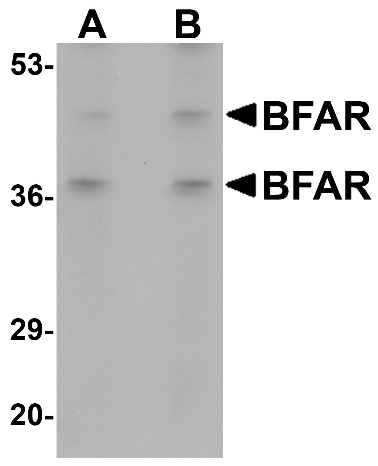 IHC-plus™ BAR / BFAR Antibody