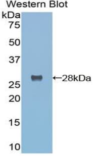 TMPRSS2 / Epitheliasin Antibody (aa284-492)