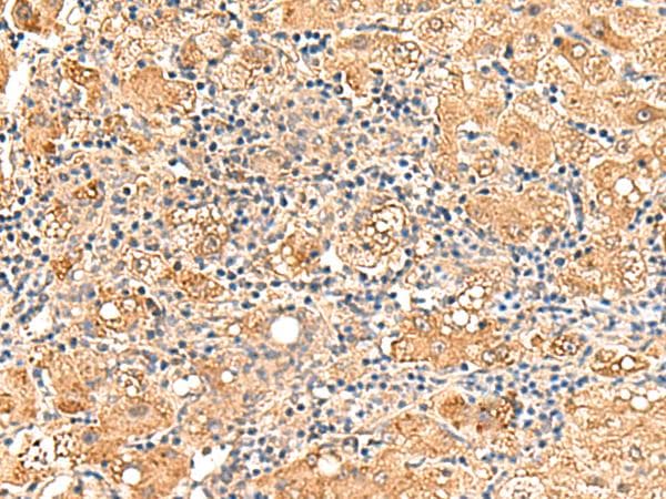 GPD1L Antibody