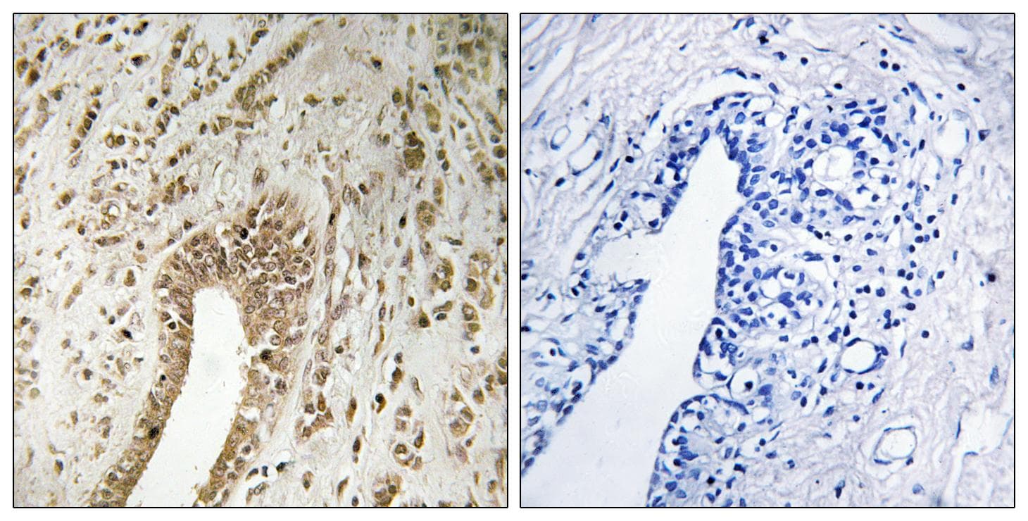 PHF3 Antibody