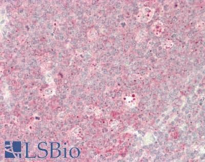 MECOM / EVI1 Antibody (aa359-408)