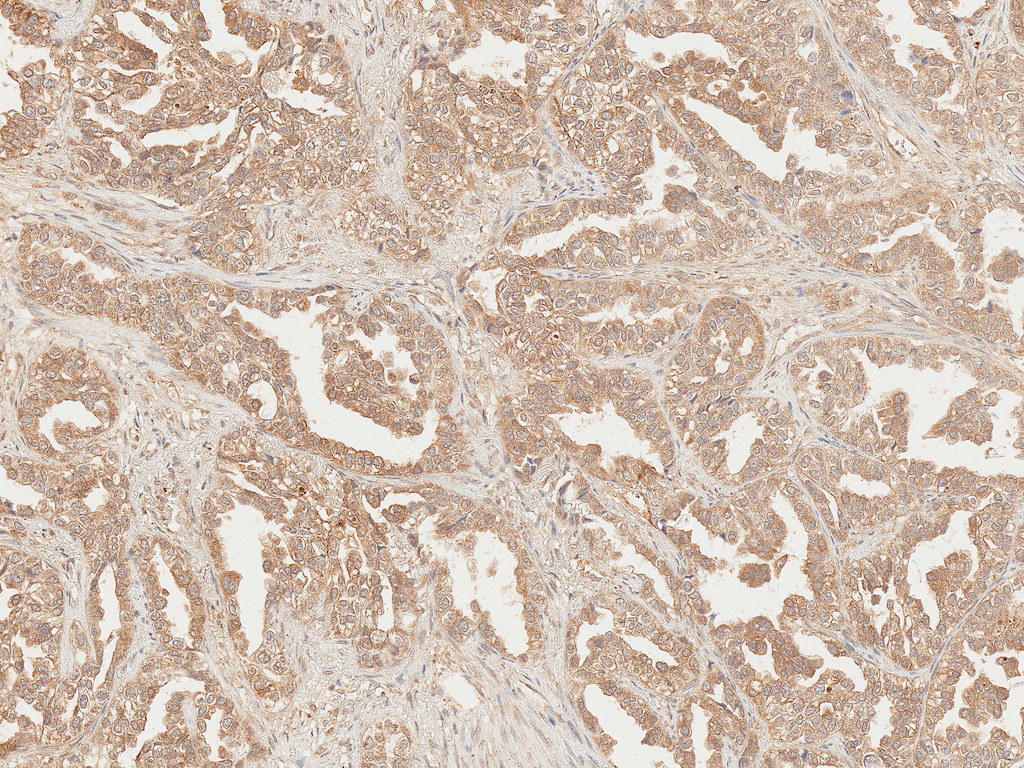 AXIN2 / Axin 2 Antibody (RPE)