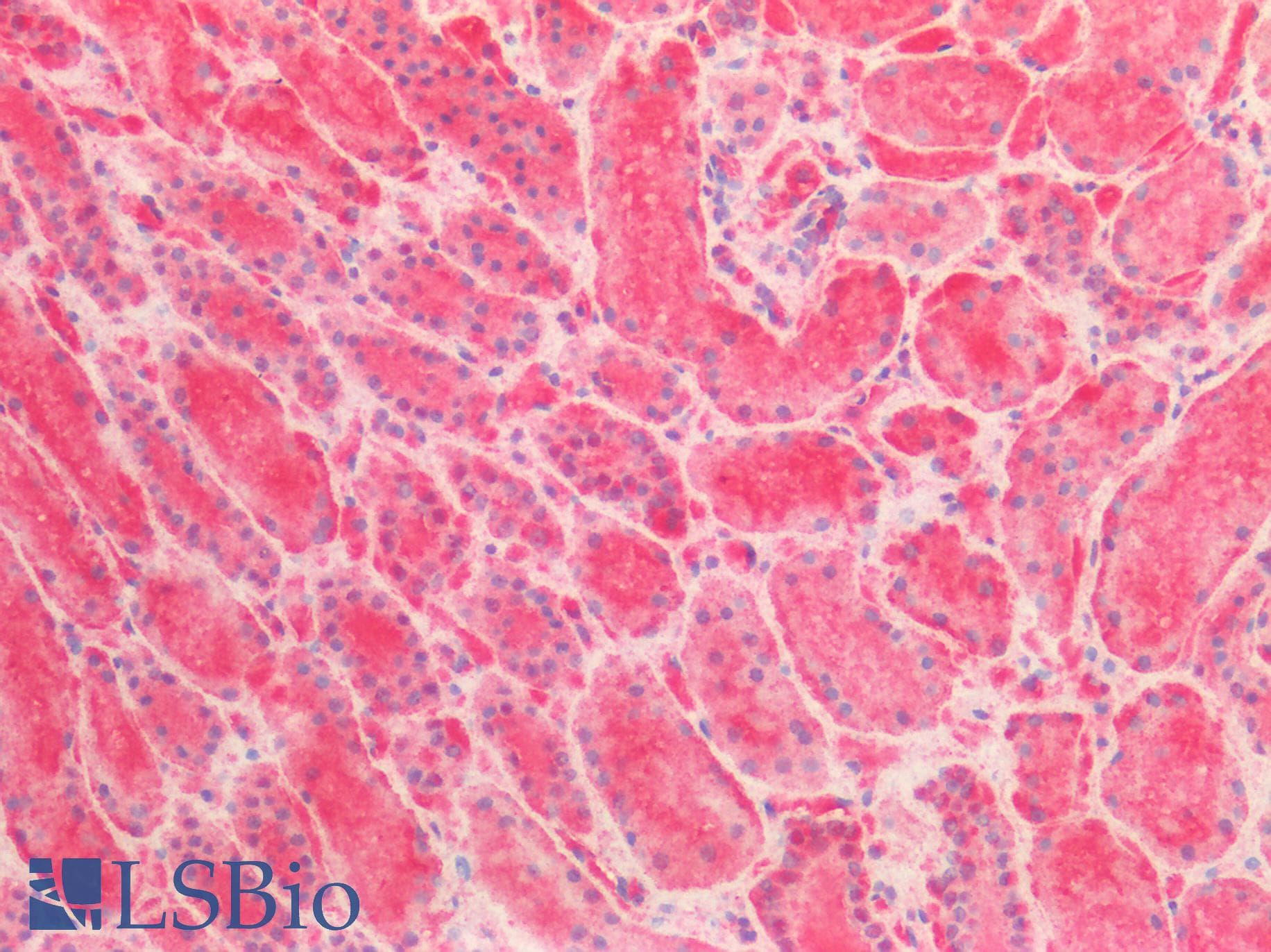 PathPlus™ BRAF / B-Raf Antibody (clone 1H12)