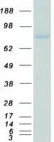 Human DDX5 Protein (Recombinant Myc-DDK (Flag))