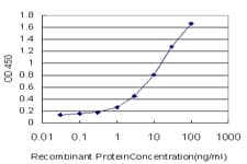 ETV5 / ERM Antibody (clone 3B10)