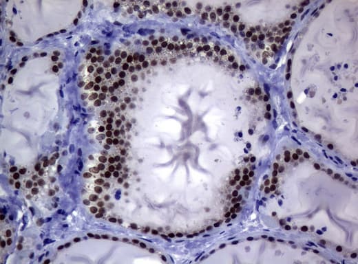MGMT Antibody (clone UMAB56)