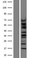 Human CTNNA3 / Alpha-3 Catenin Protein (Over-Expression Lysate Myc-DDK (Flag))