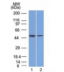 FOXA1 Antibody (clone FOXA1/1512)