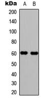 Polyclonal Rabbit anti-Human WAS / WASP Antibody (phospho-Tyr290, IHC, IF, WB)