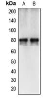 Polyclonal Rabbit anti-Human CAPN12 / Calpain 12 Antibody (Internal, WB)