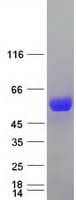 Human SLC9A3R1 / NHERF1 / EBP50 Protein (Recombinant Myc-DDK (Flag))