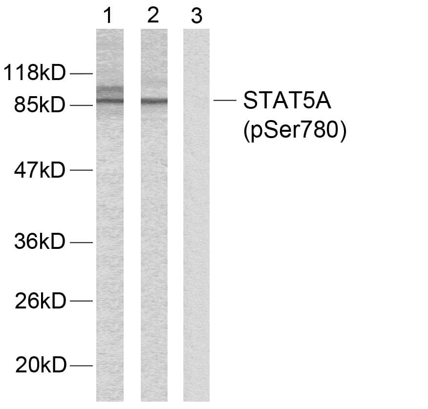 Polyclonal Rabbit anti-Human STAT5A Antibody (phospho-Ser780, IHC, WB)