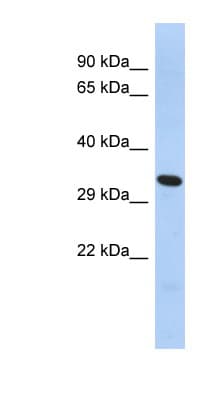 Polyclonal Rabbit anti-Human FOXK2 / ILF Antibody (aa276-303, WB)