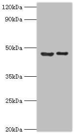 SUV39H2 Antibody (aa201-410)