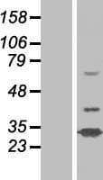 N4BP2L1 Protein (Over-Expression Lysate Myc-DDK (Flag))