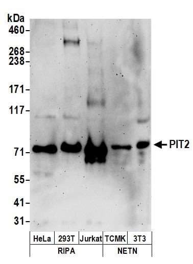 SLC20A2 / PIT2 Antibody (aa300-350)