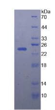 Human AFM / Afamin Protein (Recombinant His)