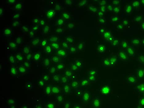Polyclonal Rabbit anti-Human POU6F1 / BRN5 Antibody (IHC, IF, WB)