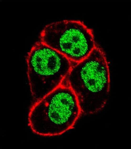 CDC73 / Parafibromin Antibody (aa132-161)
