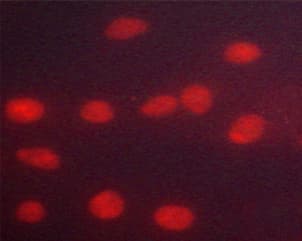 Polyclonal Rabbit anti-Human PR / Progesterone Receptor Antibody (phospho-Ser294, IF, WB)