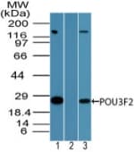 IHC-plus™ Polyclonal Rabbit anti-Human BRN2 / POU3F2 Antibody (aa240-290, IHC, WB)