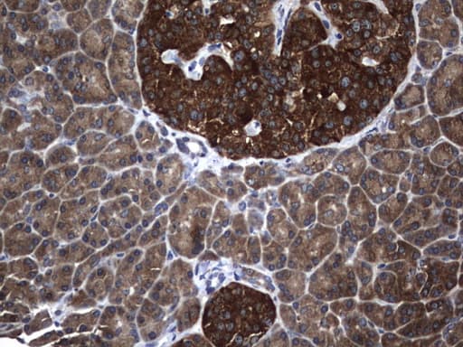 NME1 / NM23 Antibody (clone UMAB92, Carrier-free)