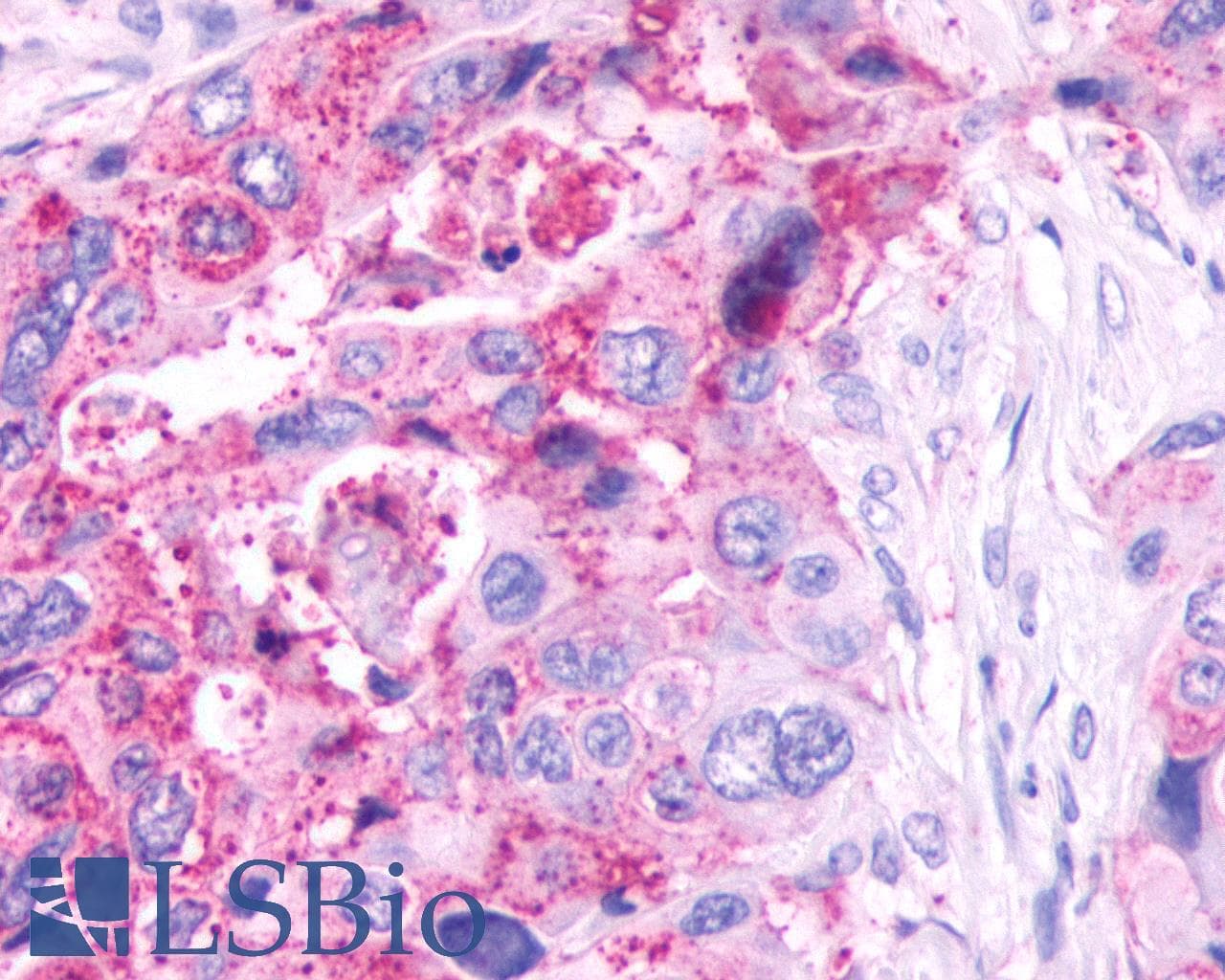PathPlus™ Polyclonal Rabbit anti-Human GPR61 Antibody (C-Terminus, IHC)