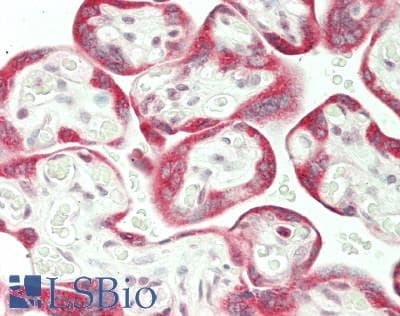 IHC-plus™ Polyclonal Rabbit anti-Human STK17B / DRAK2 Antibody (Internal, IHC, WB)