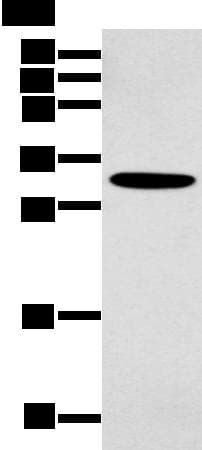 NANOS1 / NOS1 Antibody