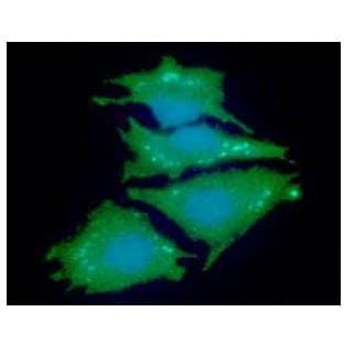 IHC-plus™ NDRG1 Antibody (clone AT11G4)