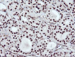 ENPEP / Aminopeptidase A Antibody (clone OTI4G8)