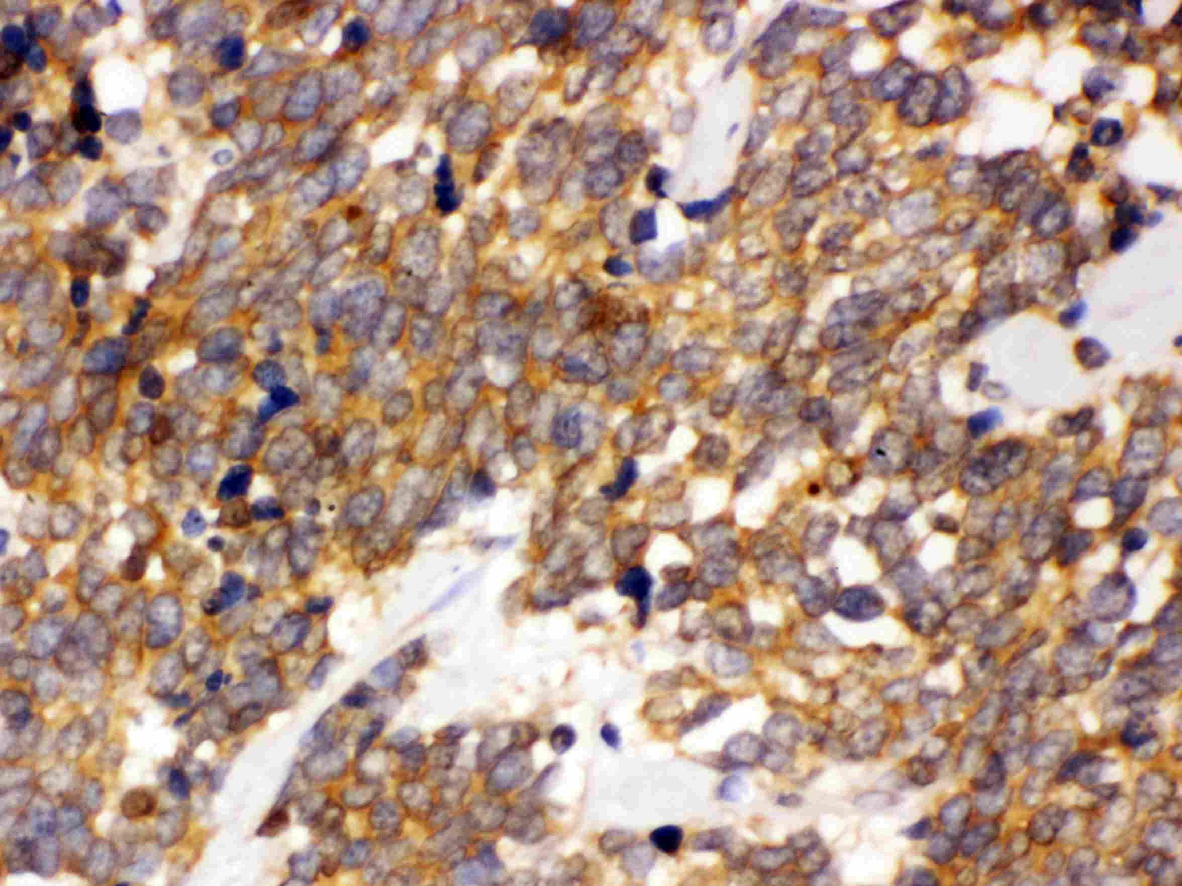 Polyclonal Rabbit anti-Human DDAH2 Antibody (IHC, WB)