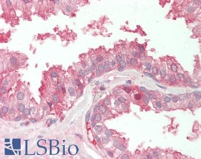 IHC-plus™ PVR / CD155 Antibody