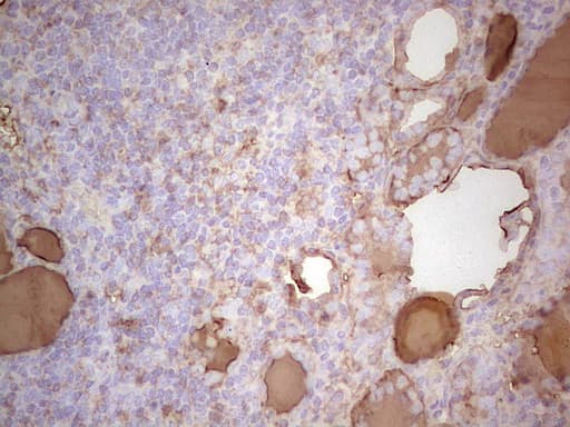 Monoclonal Mouse anti-Human TG / Thyroglobulin Antibody (clone OTI1D6, aa20-358, IHC)