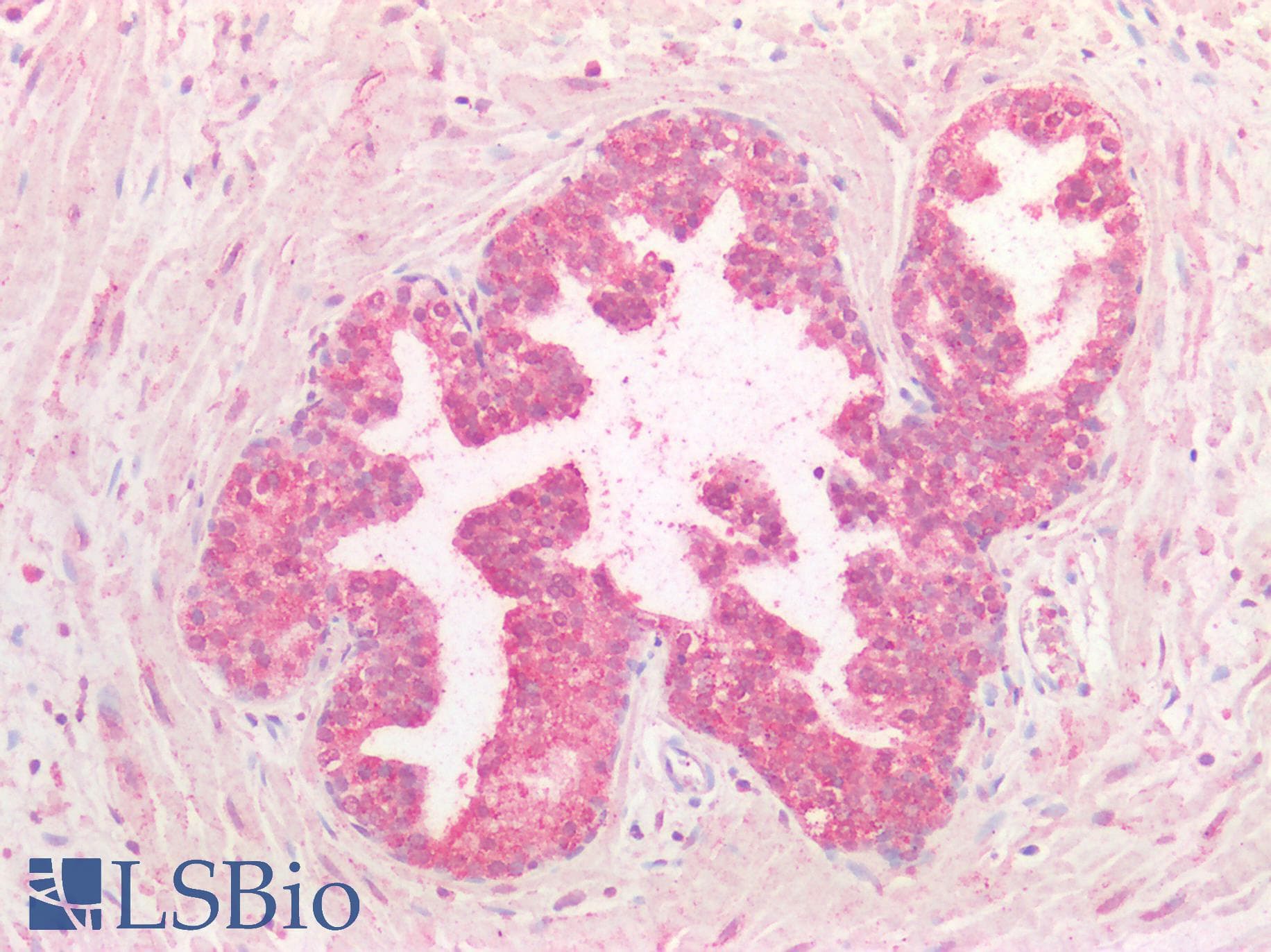 IHC-plus™ FOLR1 / Folate Receptor Alpha Antibody