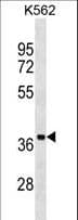Polyclonal Rabbit anti-Human UBLCP1 Antibody (aa222-248, WB)