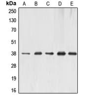 ERCC1 Antibody (Internal)