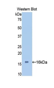TTR / Transthyretin Antibody (aa21-147)