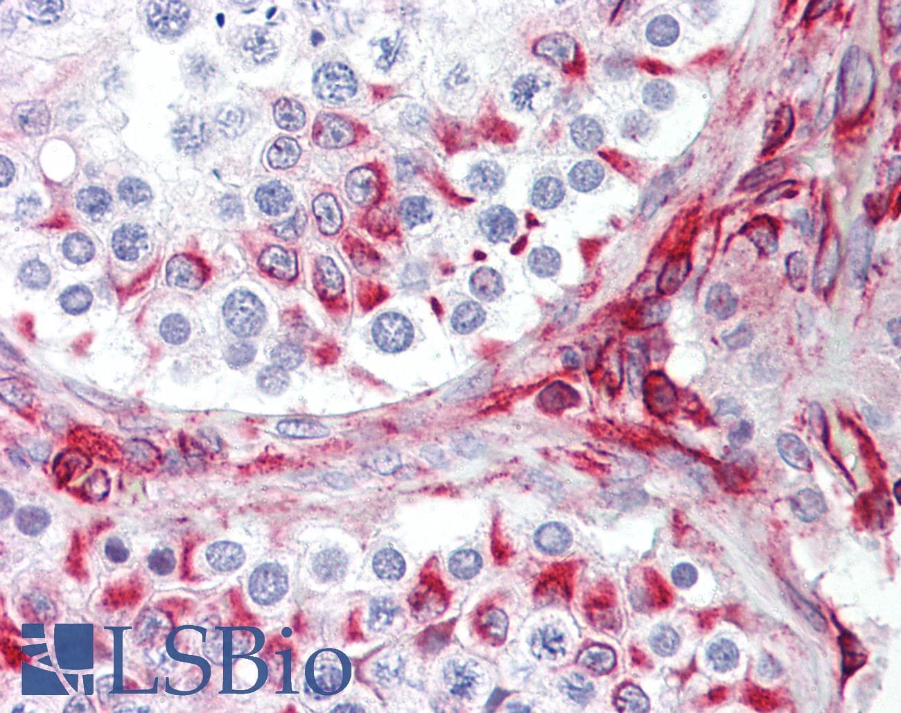 IHC-plus™ Polyclonal Rabbit anti-Human BRAF / B-Raf Antibody (aa411-460, IHC, WB)