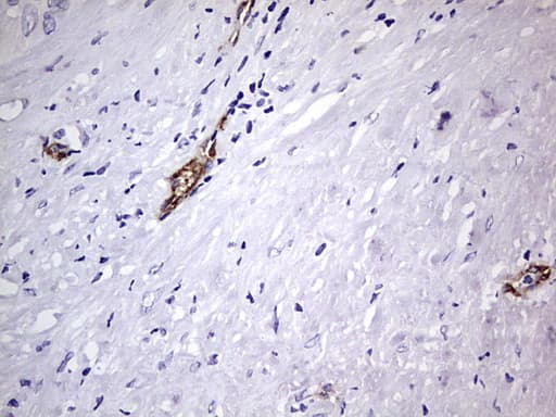 VWF / Von Willebrand Factor Antibody (aa764-1263, clone OTI7G3, Carrier-free)
