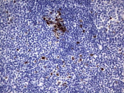 MKI67 / Ki67 Antibody (aa1160-1493, clone OTI6C12)