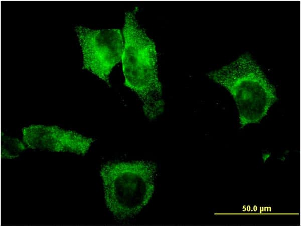 CEL / Carboxyl Ester Lipase Antibody (clone 3C8)