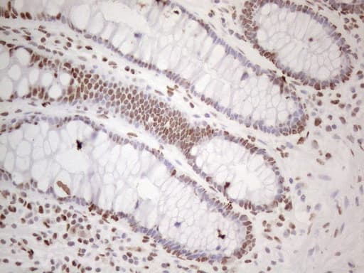 Monoclonal Mouse anti-Human HNRNPL / hnRNP L Antibody (clone OTI4E5, aa270-502, IHC)