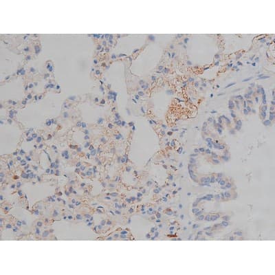 MAPT / Tau Antibody (phospho-Ser356)