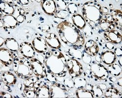 RIP1 / RALBP1 Antibody (clone OTI6G10)