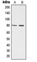 TP73 / p73 Antibody (N-Terminus)